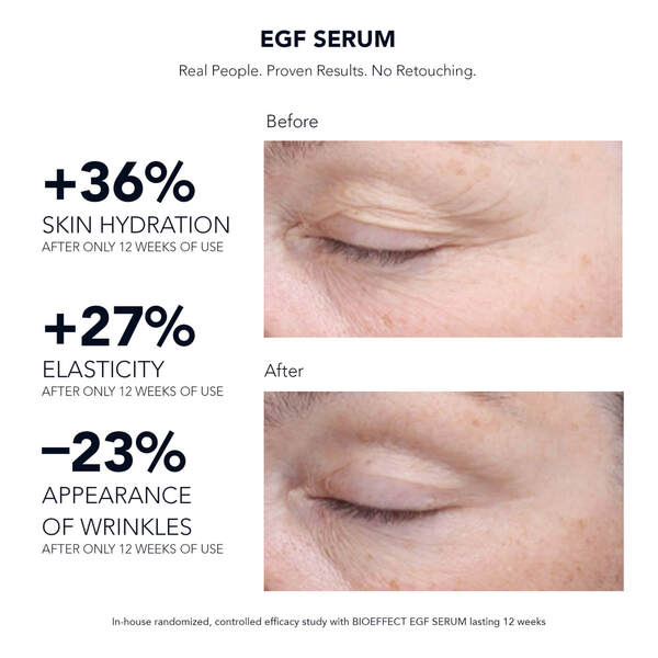  Bioeffect Bioeffect Egf Serum (various Sizes)   15ml 