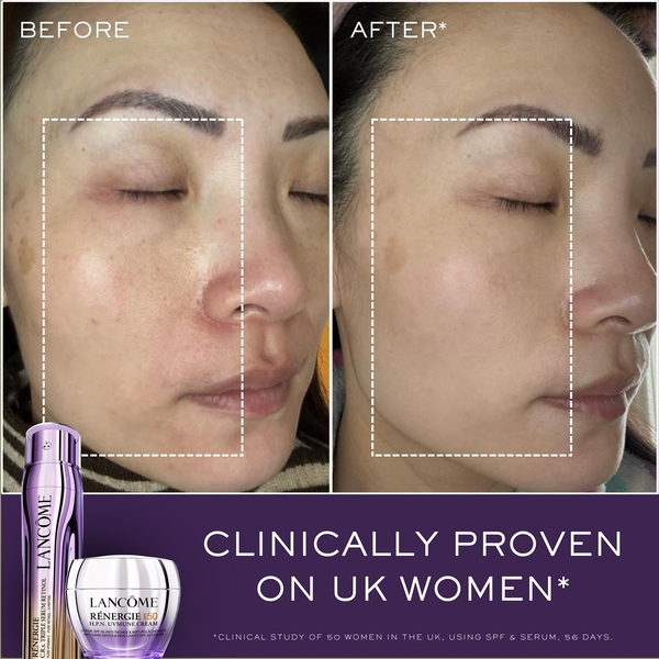  Lancome Lancôme Renergie Triple Serum Retinol Routine Set 