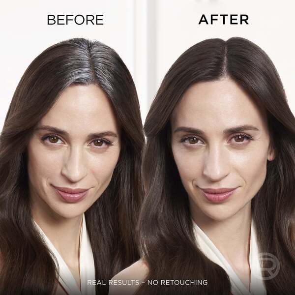  L'oréal Paris L’oréal Paris Magic Retouch Temporary Instant Root Concealer Spray 75ml (various Colours)   Dark Brown 