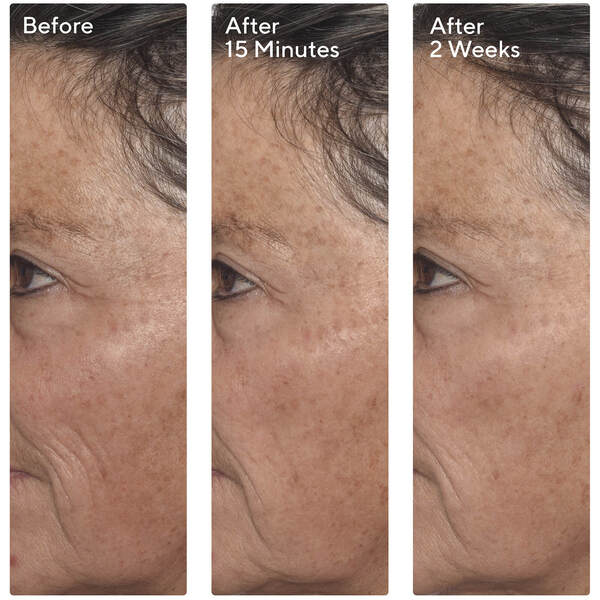  Murad Murad Targeted Wrinkle Corrector 15ml 