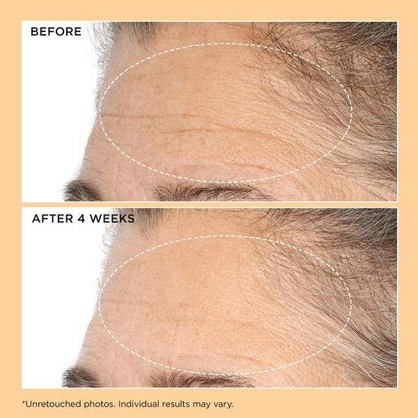  Perricone Md Perricone Md Neuropeptide Deep Crease Serum 