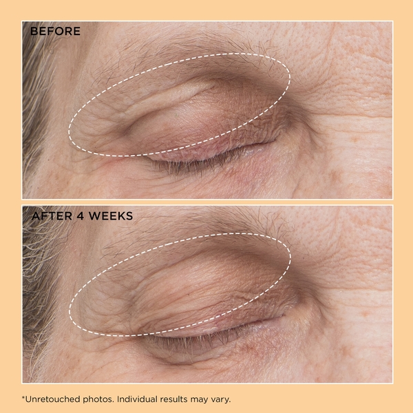  Perricone Md Perricone Md Neuropeptide Eyelid Lift Serum 